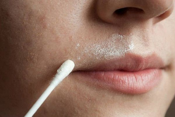 Remedies To Remove Unwanted Facial Hair Easy Ways To Remove Hair