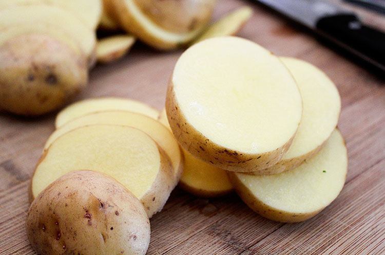 potato for freckles