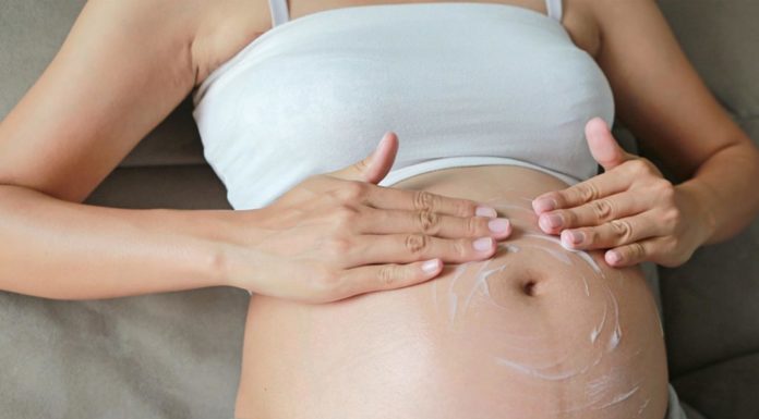 how to remove pregnancy stretch marks