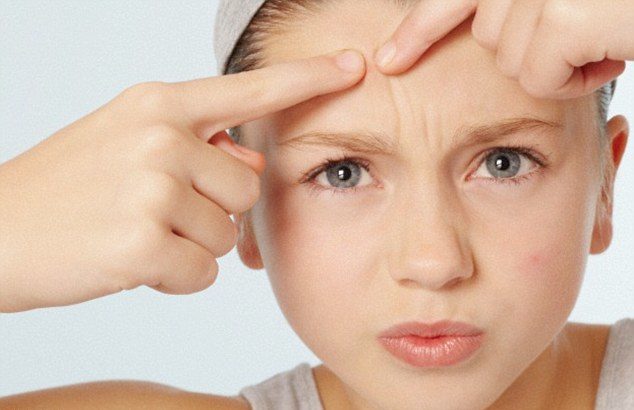 how to prevent pimples