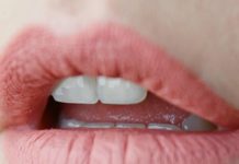 lip wrinkles