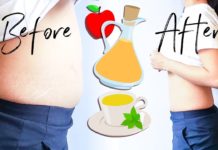 How to get rid of bloating