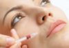 how to get rid of smoker's lines