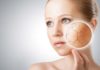 foods for dry skin