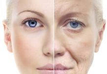 Solve Aging Skin Problems