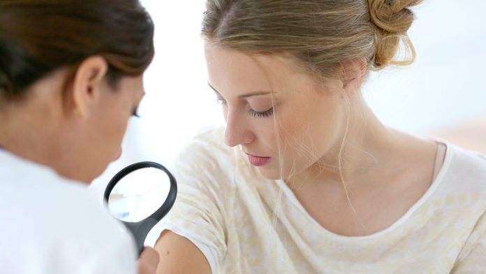 how to chose a dermatologist