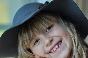 ridges  on teeth