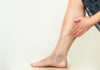 spider veins