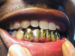 permanent gold teeth