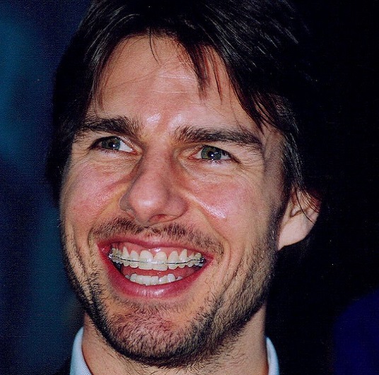tom cruise teeth before and after 