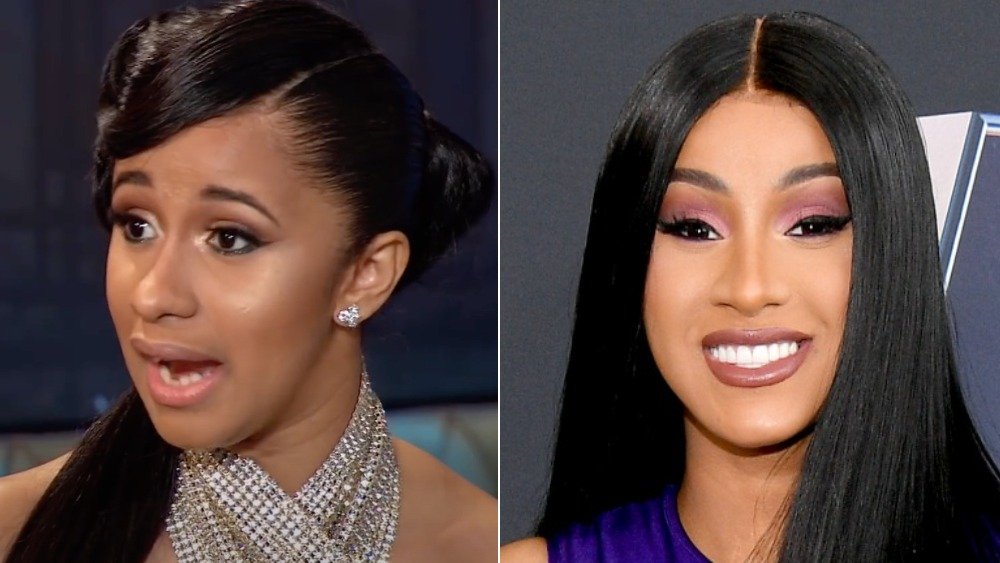 All about Cardi B Teeth Before and After - A Best Fashion.