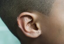 ear seeds for anxiety
