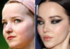 Dove Cameron Before And After Plastic Surgery