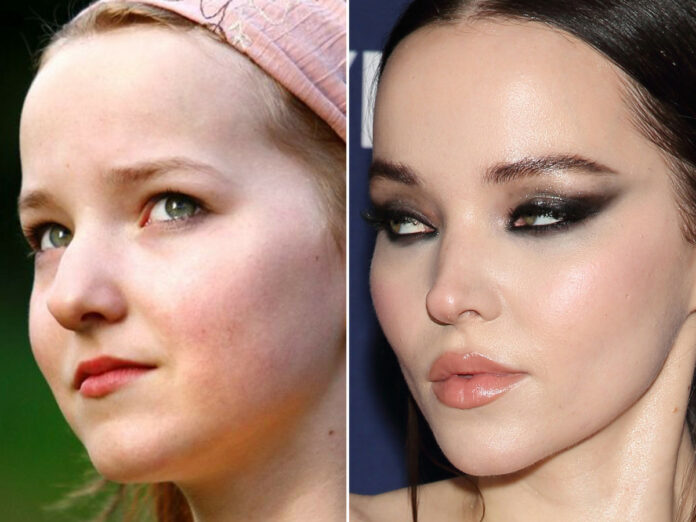 Dove Cameron Before And After Plastic Surgery