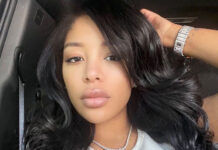 k Michelle before surgery