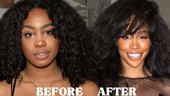 SZA Before and After Surgery