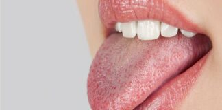 cotton mouth meaning