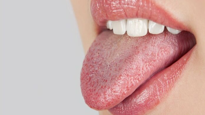 cotton mouth meaning