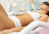 laser hair removal