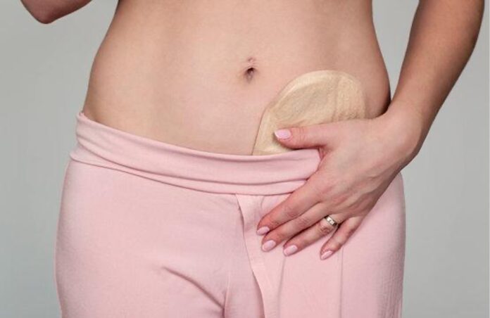 Celebrities with a Stoma Bag