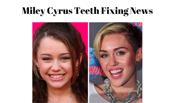 miley cyrus teeth